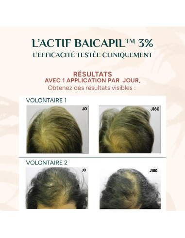 Nayana - Sérum croissance capillaire